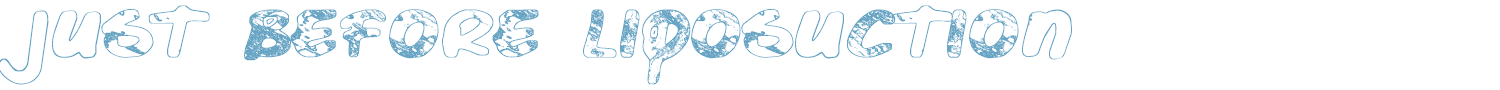 sample Just Before Liposuction font